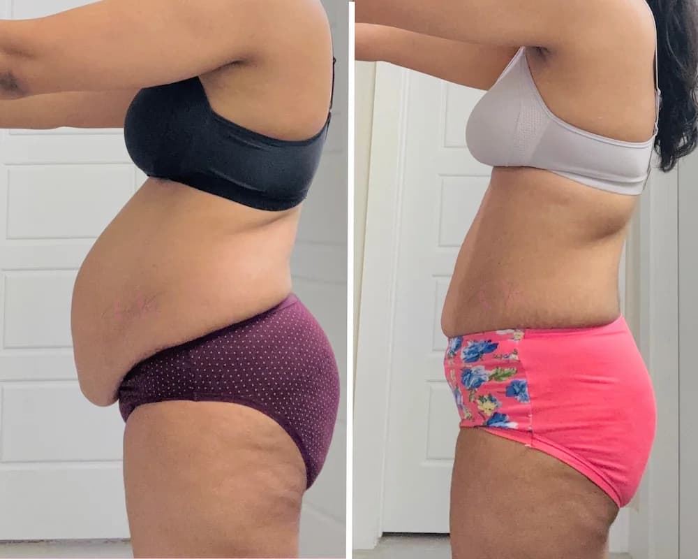 Before and after transformation result