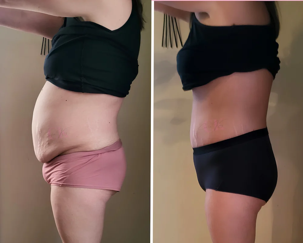 Before and after transformation result